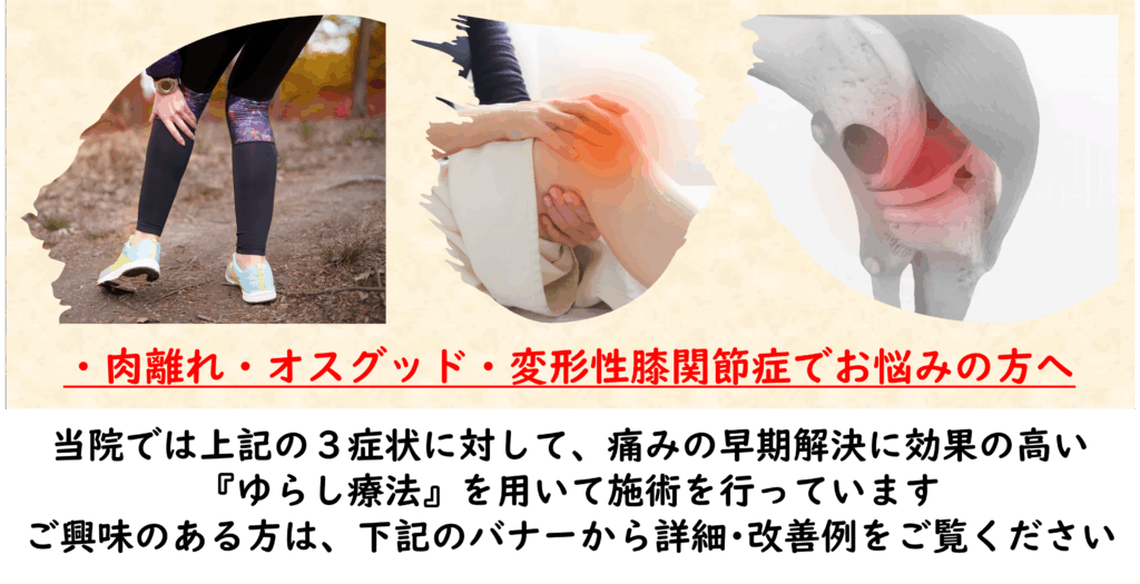 ゆらし療法案内