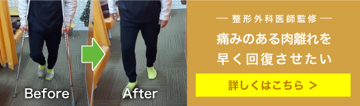 ゆらし療法肉離れ