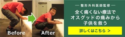 ゆらし療法オスグッド